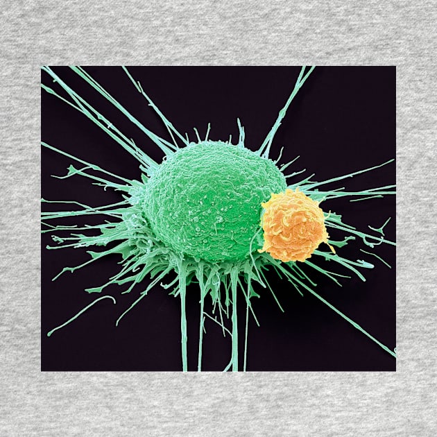 T lymphocyte and cancer cell, SEM (C022/6435) by SciencePhoto